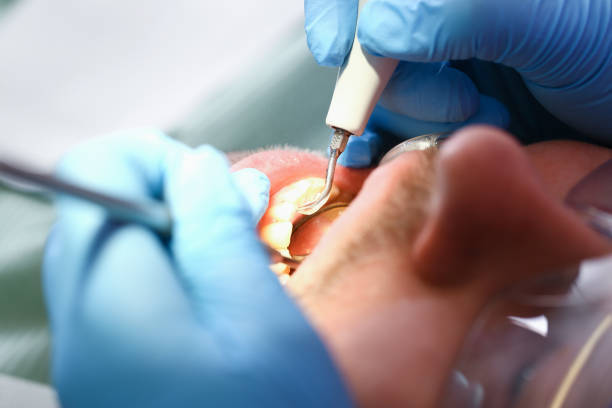 Best Emergency Denture Repair in Emigsville, PA